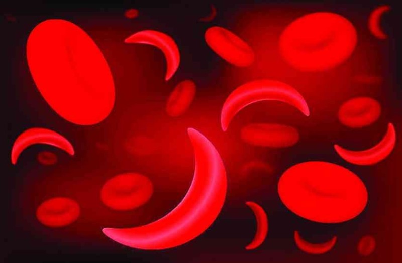 सिकलसेल एनेमियाका बिरामीको निःशुल्क उपचार माग